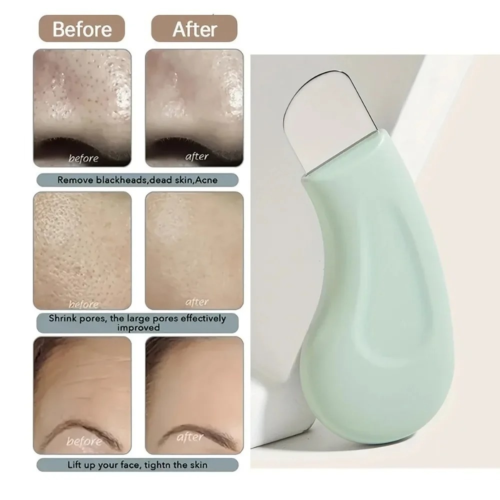 Deep Cleansing Blackhead White - Nasal Aspirator 评论和价格