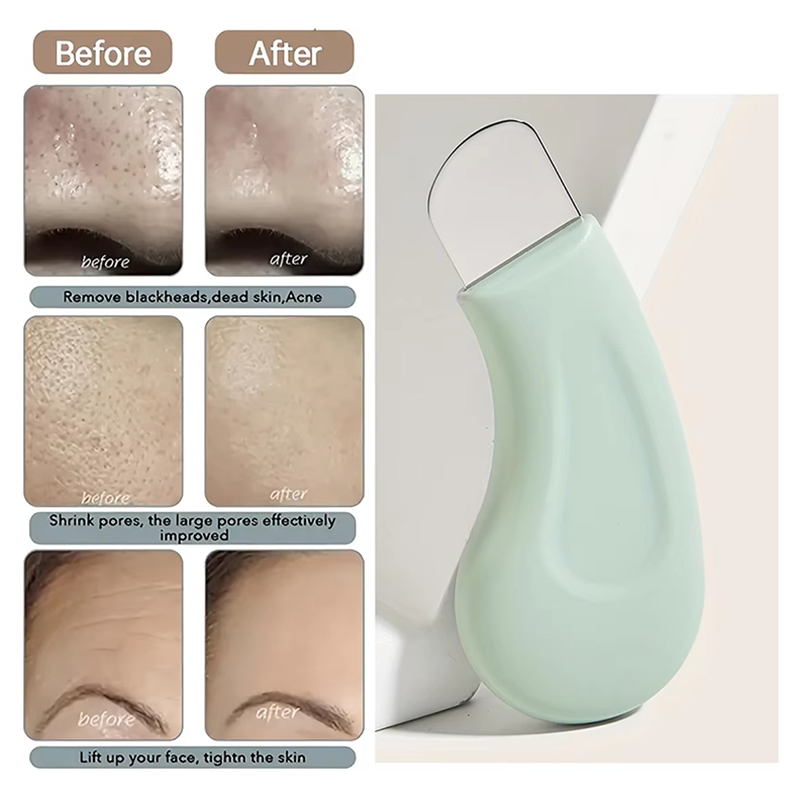 Deep Cleansing Facial Blackhea - Nasal Aspirator 评论和价格